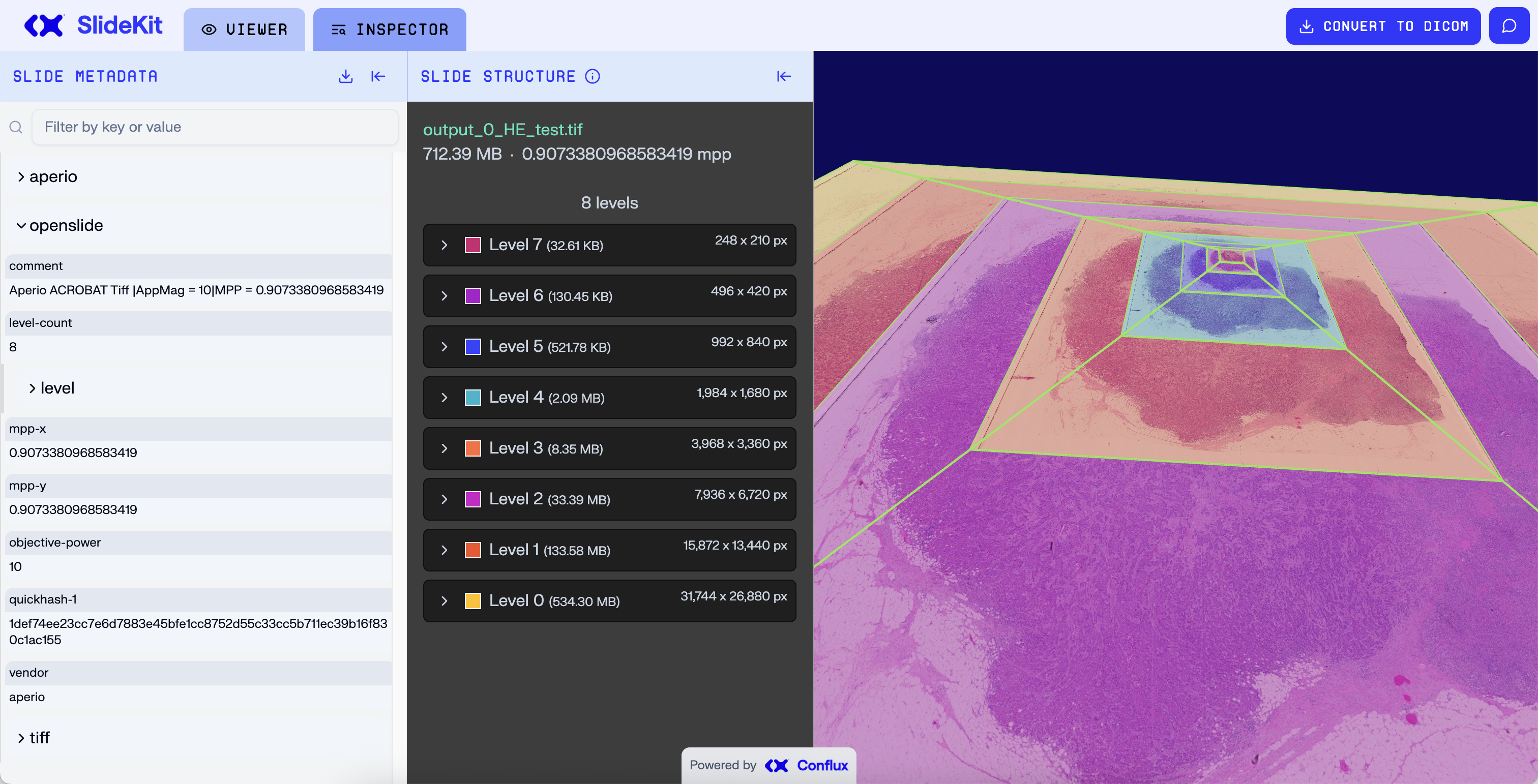SlideKit running in the browser showing a whole slide image viewer