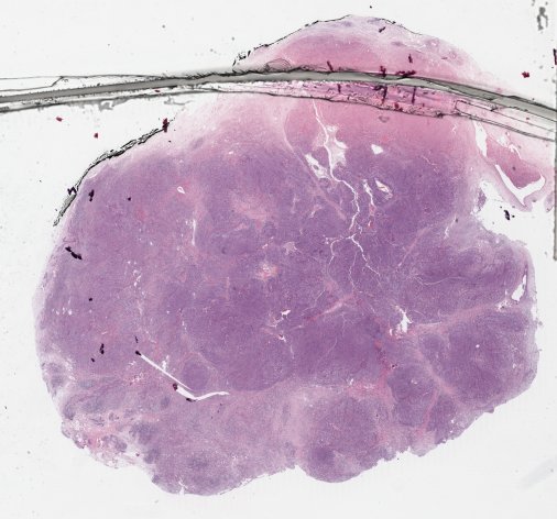TCGA-C8-A12V-01Z-00-DX1 slide with a crack